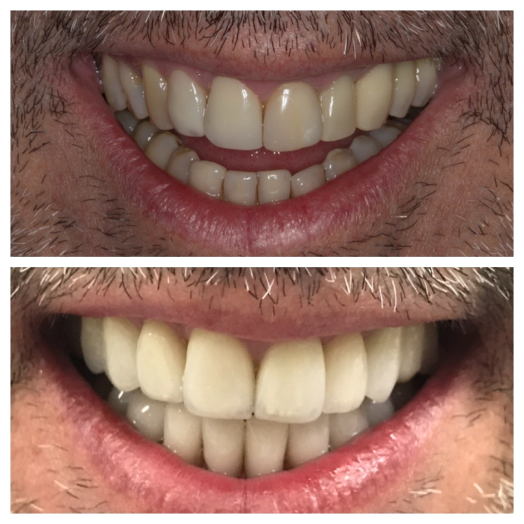 20F8CEE8-7488-445B-8A28-E195E7BBFD2A.JPG 1